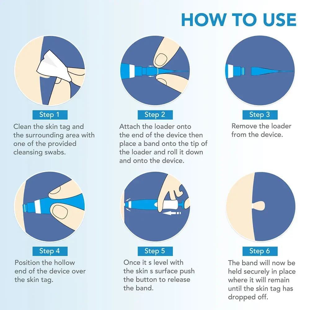 2 in 1 Skin Tag Remover Kit Mole Wart Remover Mahcine  Auto Micro Skin Tag Treatment Removal Tool Facial Beauty Care Device