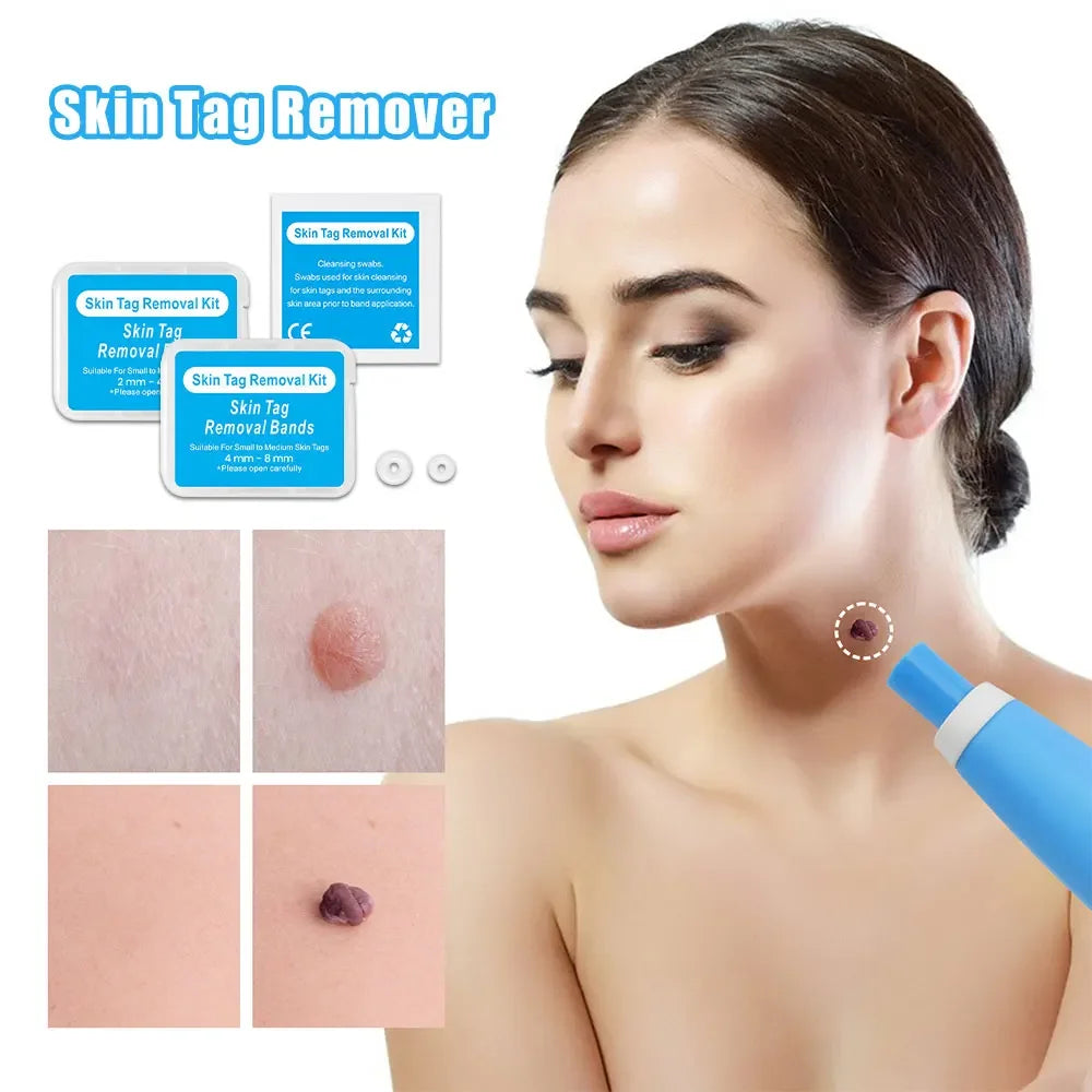 2 in 1 Skin Tag Remover Kit Mole Wart Remover Mahcine  Auto Micro Skin Tag Treatment Removal Tool Facial Beauty Care Device