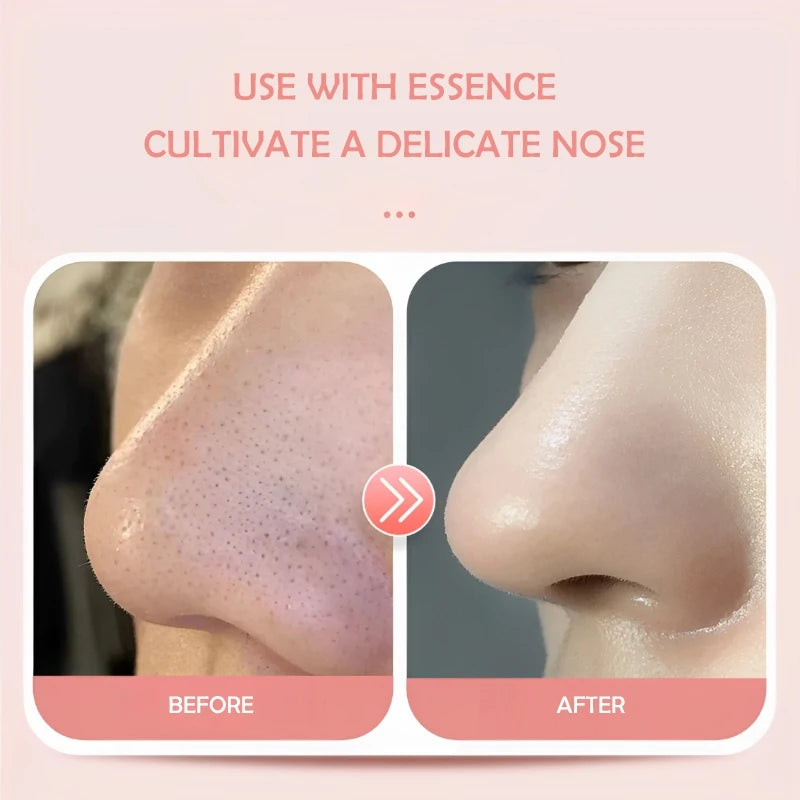 100pcs Disposable Nose Mask Paper Hydrating Nose Patches for Blackhead Removal Cosmetic Wet Compress Facial Mask Skin Care Tools